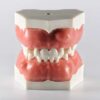 Модель верхней и нижней челюсти для отработки манипуляций в хирургической стоматологии