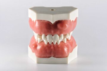Модель верхней и нижней челюсти для отработки манипуляций в хирургической стоматологии