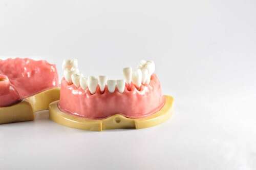 Модель верхней и нижней челюсти с 28 заменяемыми зубами с прозрачными корнями для отработки навыков в эндодонтии
